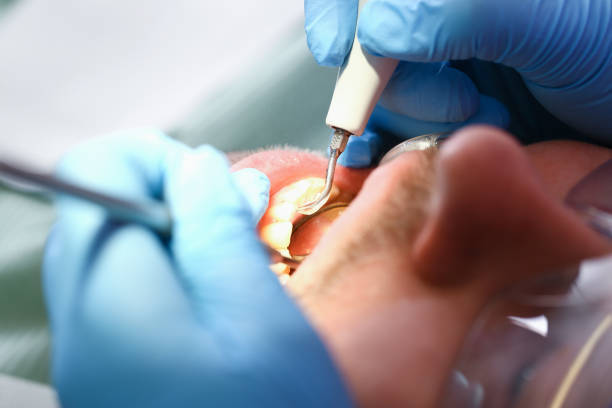 Best Emergency Gum Treatment in Knob Noster, MO