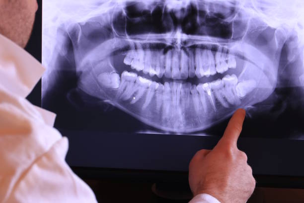 Best Emergency Treatment for Dental Infections or Abscesses in Knob Noster, MO